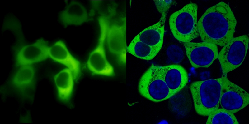 epifluorescence_versus_confocal_imaging