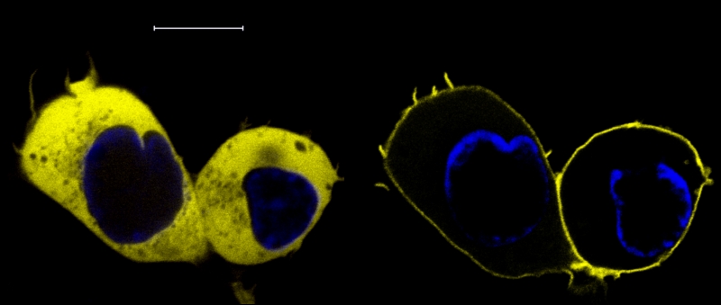 confocal_imaging_before_and_after_PKCalpha_translocation